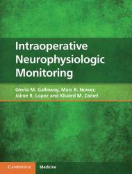 Intraoperative Neurophysiologic... - Galloway